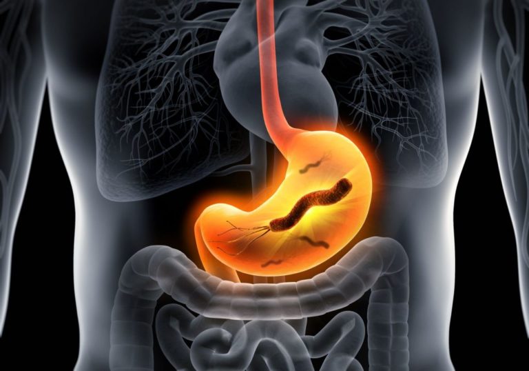 Ricerca Helicobacter Pylori Nelle Feci TEST HELICOBACTER PYLORI - Sabina Medica